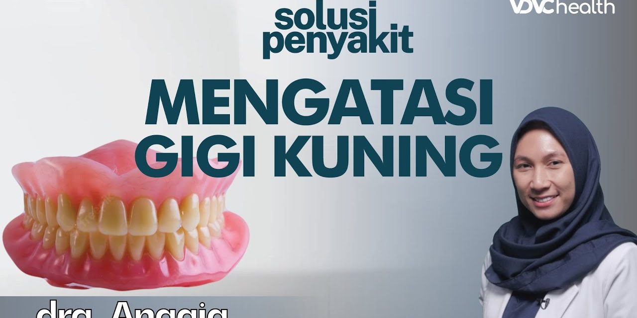 Kondisi Gigi Kuning Bikin Kurang Percaya Diri? Kenali Faktanya