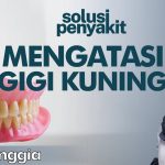 Kondisi Gigi Kuning Bikin Kurang Percaya Diri? Kenali Faktanya